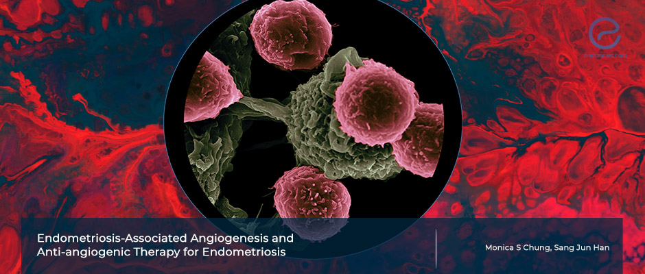 Does inhibiting the formation of the new blood vessels aid in endometriosis  treatment?