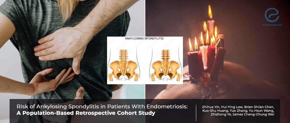 Ankylosing Spondylitis and Endometriosis