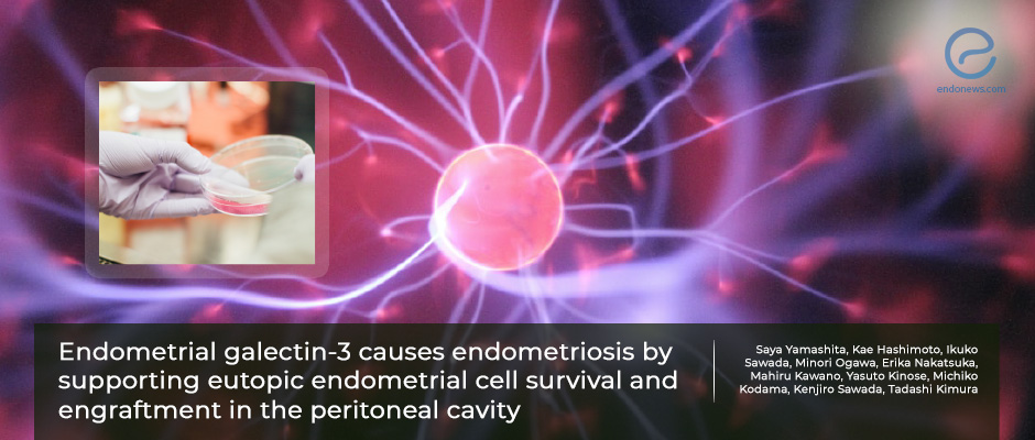 A new potential therapeutic target in endometriosis: Galectin-3