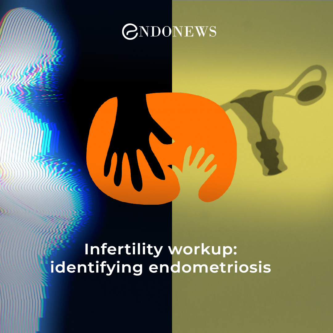endometriosis-associated-infertility-how-to-manage-endonews