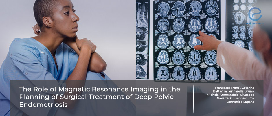 Validity of Magnetic Resonance Imaging for Deep Pelvic Endometriosis.