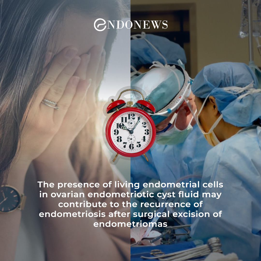 Endometriotic cyst fluid and the postoperative recurrence of