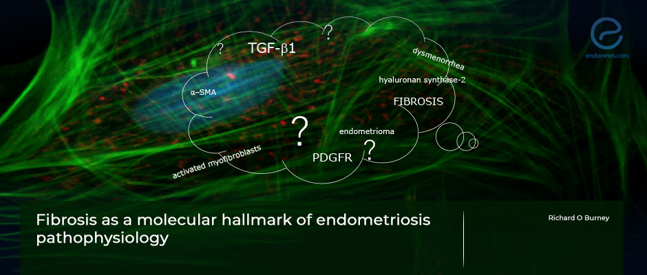 Fibrosis is not only a histological finding in endometriosis