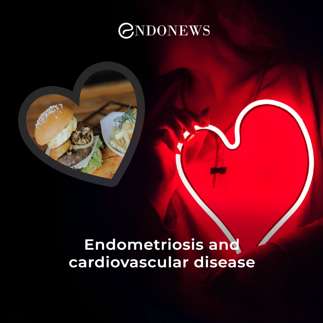Coexistence of endometriosis and cardiovascular diseases EndoNews