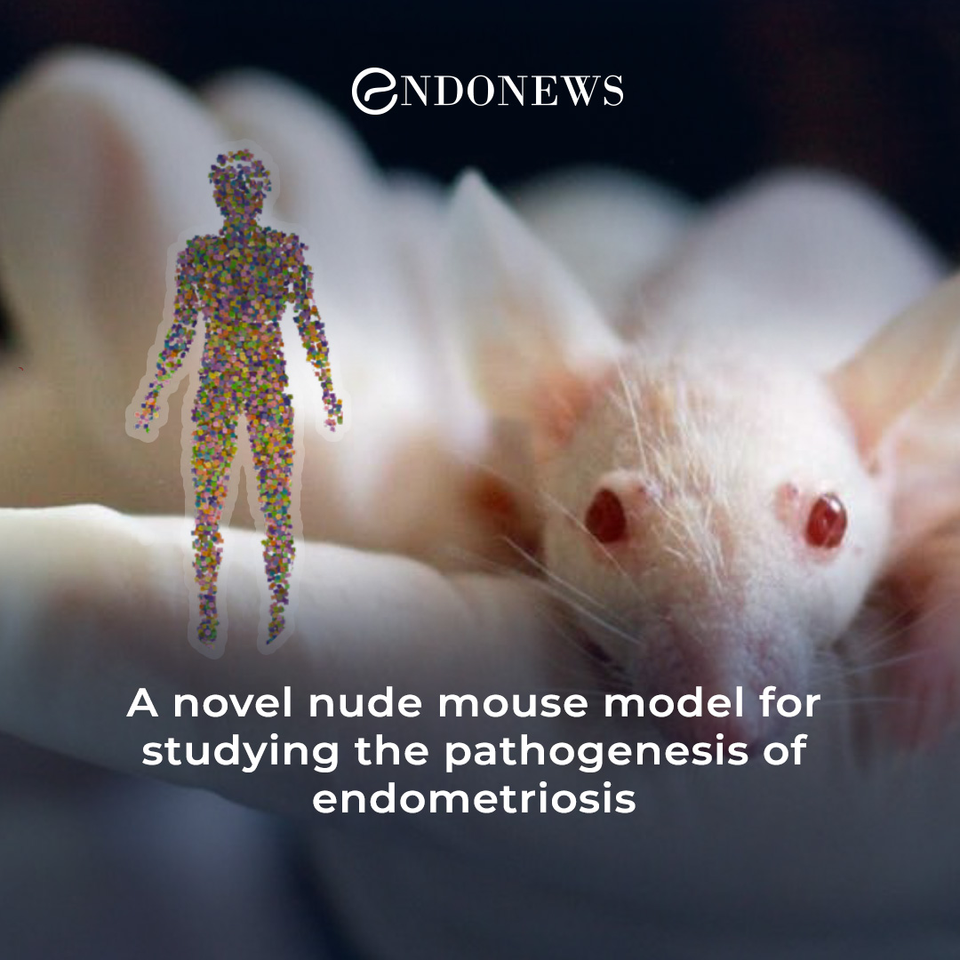 Researchers Develop New Mouse Model of Endometriosis EndoNews