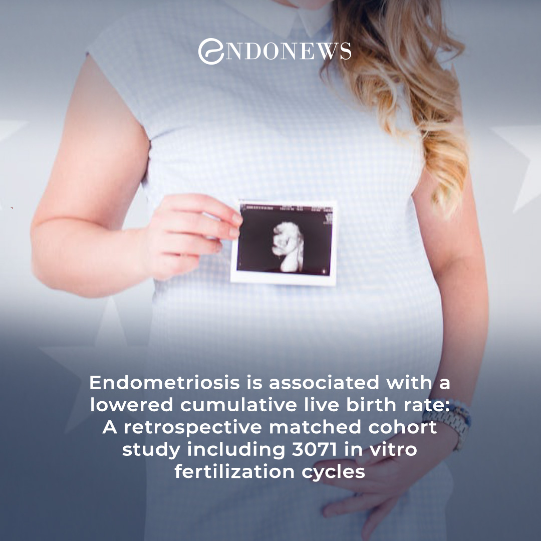 Endometriosis and the cumulative live birth rate in IVF cycles. EndoNews