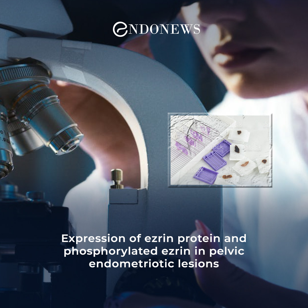 Organizing structural protein Ezrin and its active form in