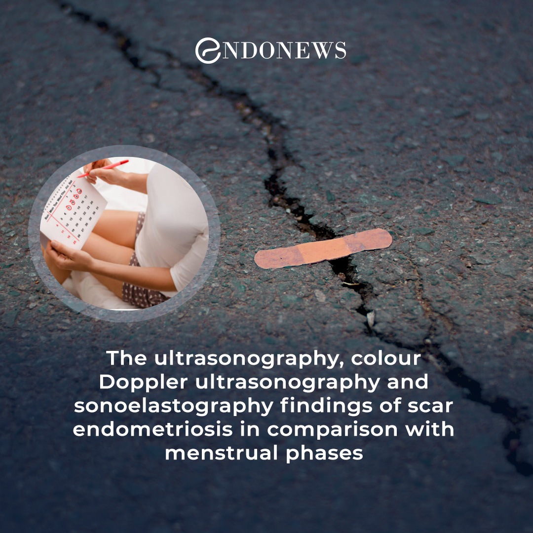 Time to change out taboos about the radiologic evaluation of scar endometriosis EndoNews