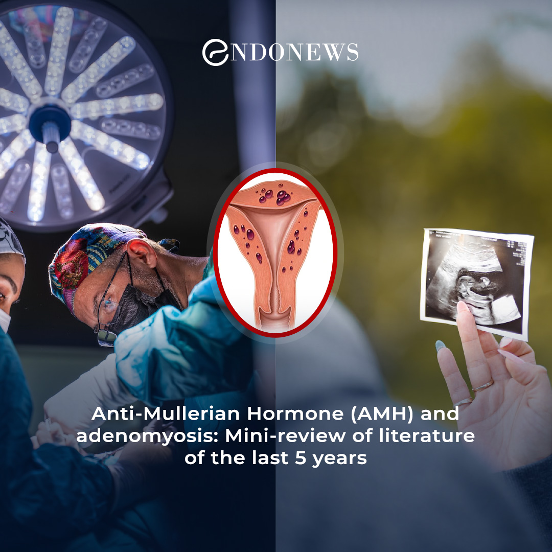 Adenomyosis and the antimullerian hormone levels EndoNews