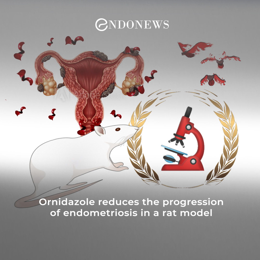 Antimicrobial agent ornidazole yields promising effects in an animal