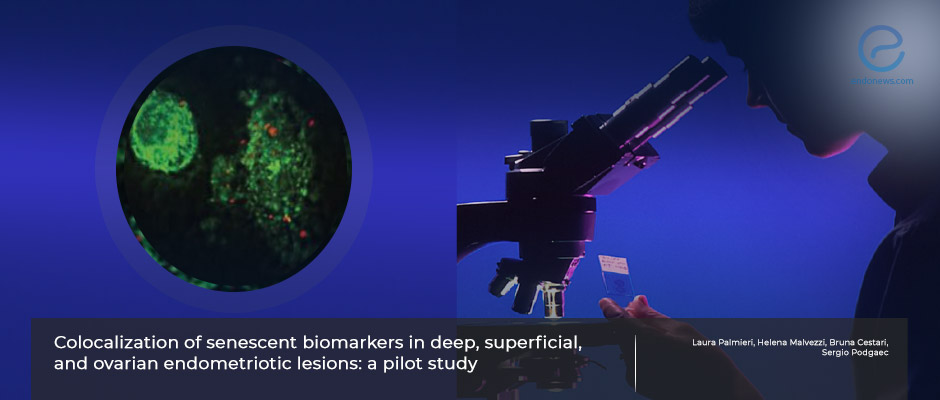 Creating a reliable indirect immunofluorescence protocol as a promising diagnostic tool for endometriosis