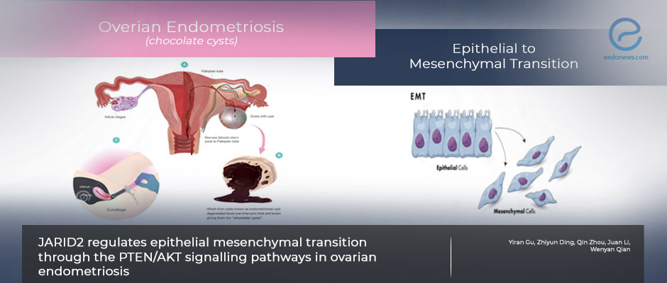 Molecular Alterations in Ovarian Endometriosis