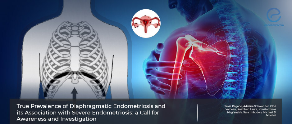 Diaphragmatic Endometriosis: a Call for Awareness