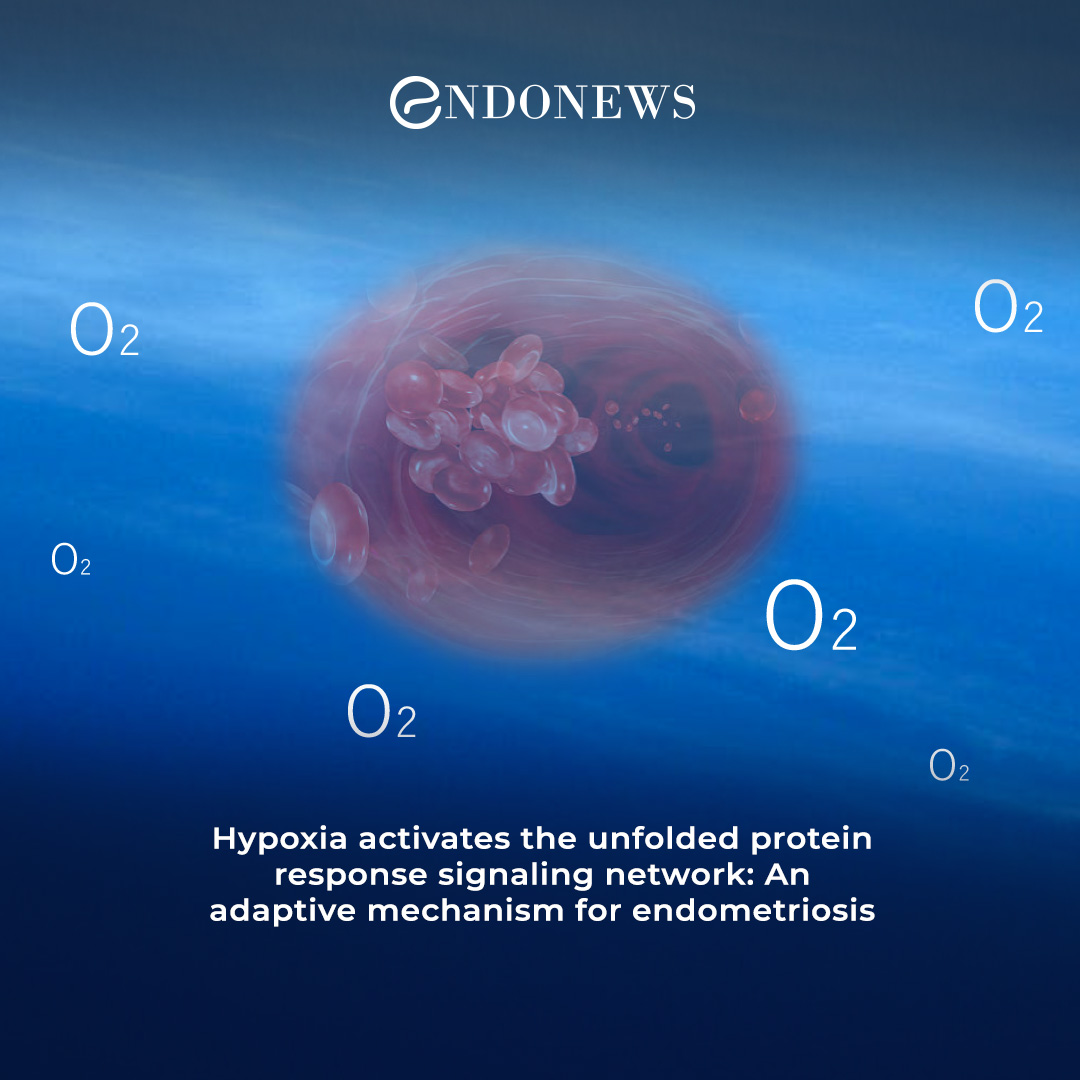 Hypoxia and endometriosis A review of mechanisms EndoNews