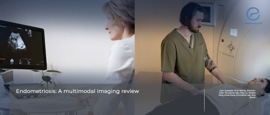 A review of multimodal imaging modalities for endometriosis.