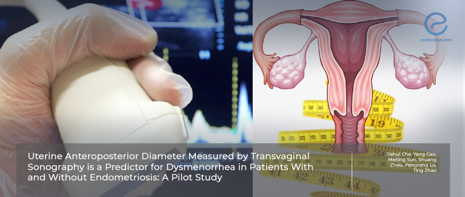 The bigger the uterus, the more painful the dysmenorrhea even if you don’t have endometriosis.