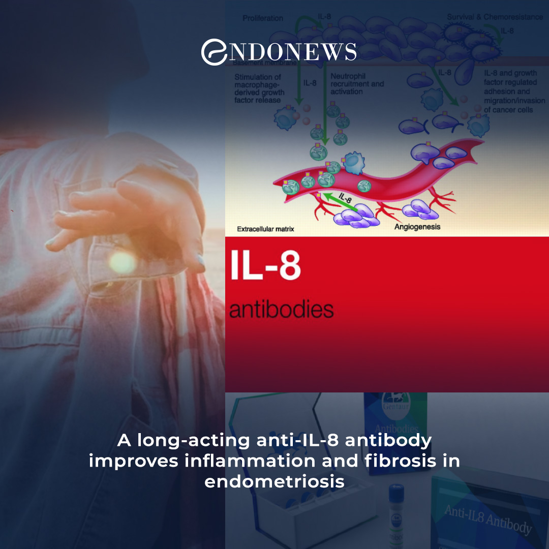 anti-il-8-antibody-ameliorates-inflammation-and-fibrosis-a-promising