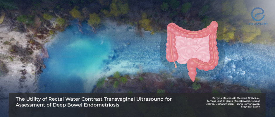 Getting help from water to replace colonoscopy and MRI for the diagnosis of deep bowel endometriosis. 