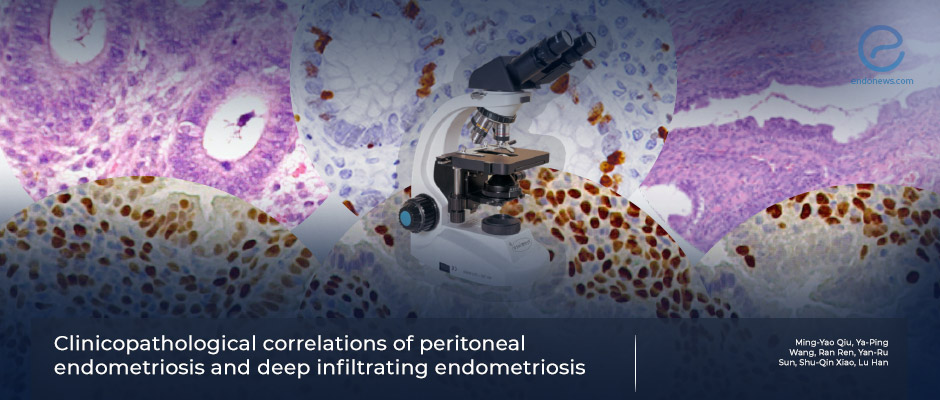 A pioneering study on clinicopathologic features of biopsies of endometriotic lesions 