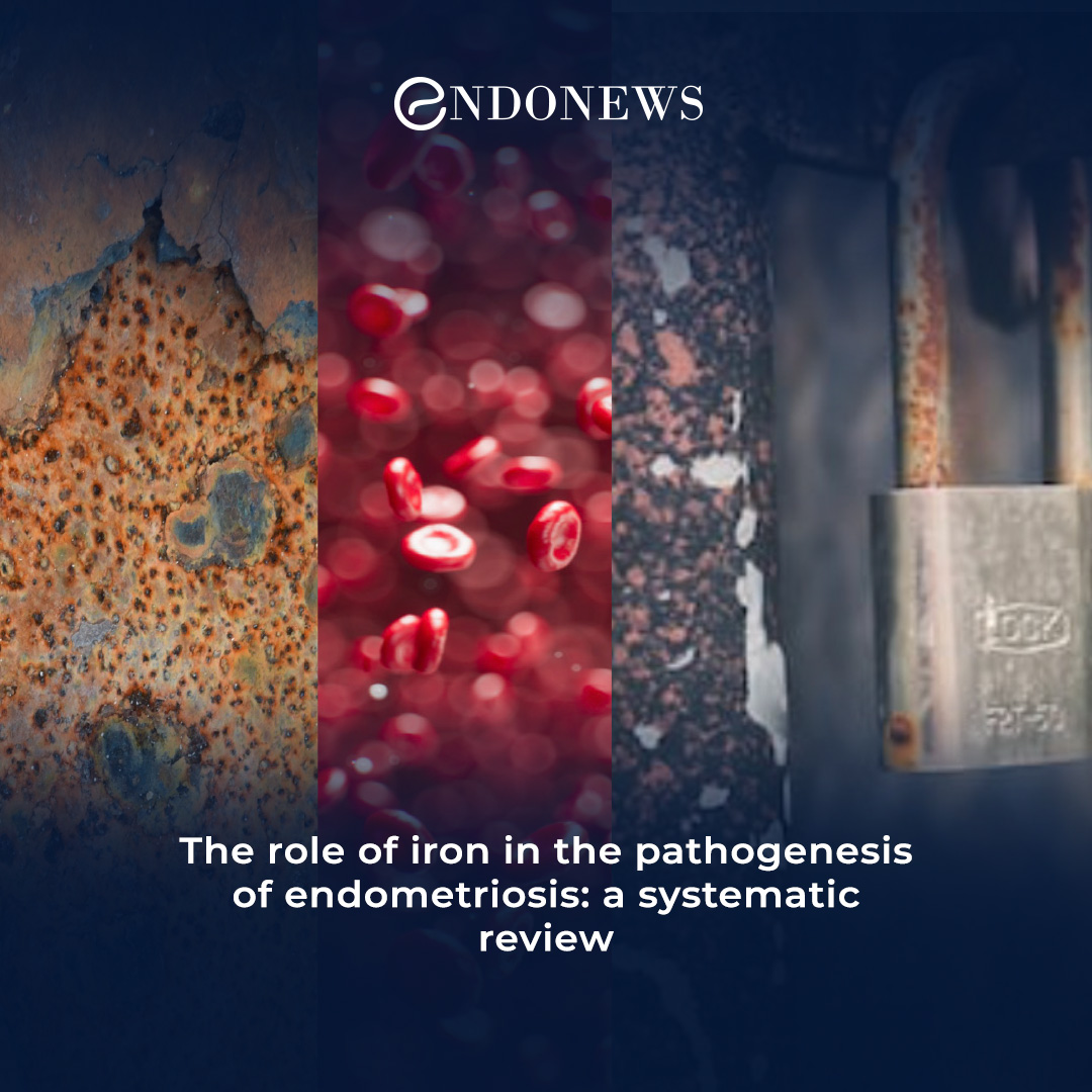 Elevated Iron Levels In endometriosis Pathogenesis EndoNews elevated-iron-levels-in-endometriosis-pathogenesis-endonews
