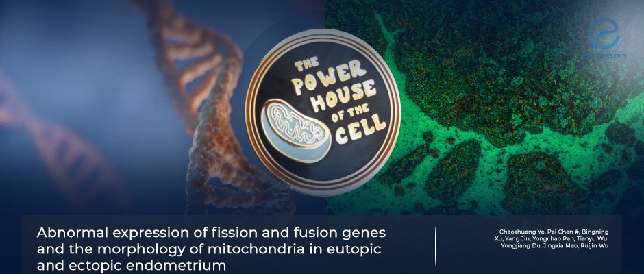 Alterations of mitochondrial dynamics in endometriosis