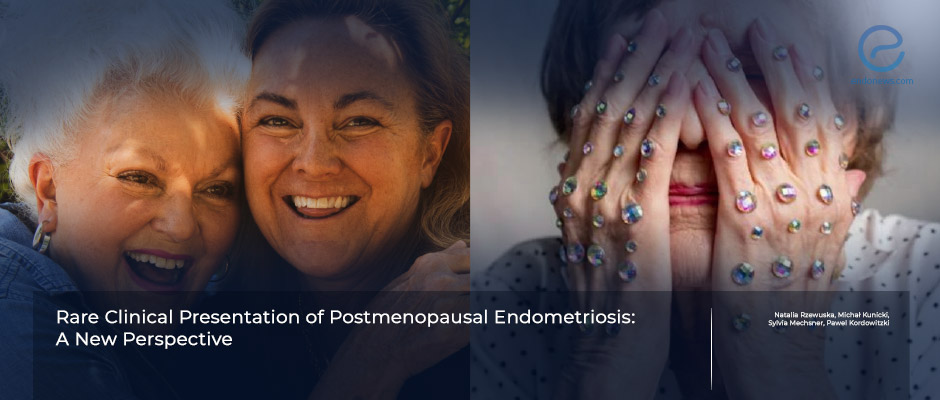 Diagnosis and the Treatment of Postmenopausal Endometriosis