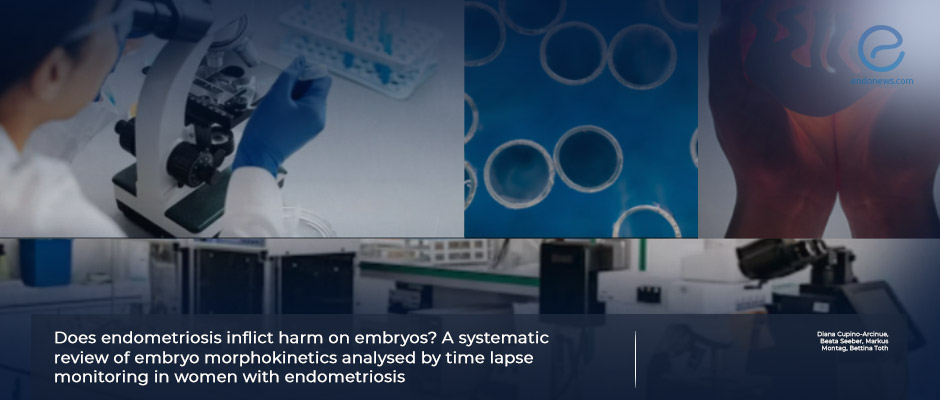 Embryo Morphokinetics of Endometriotic Patients by Time Lapse Monitoring