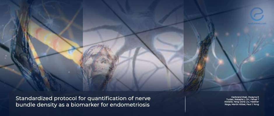 Quantification of nerve bundle density as a biomarker for endometriosis utilizing PGP9.5 immunostaining