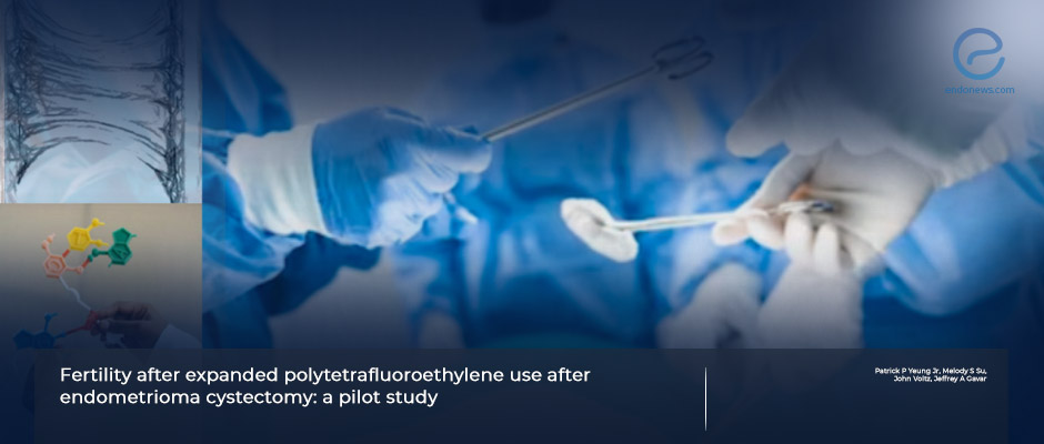 Ovarian adhesion prevention with polytetrafluoroethylene during endometrioma surgery.