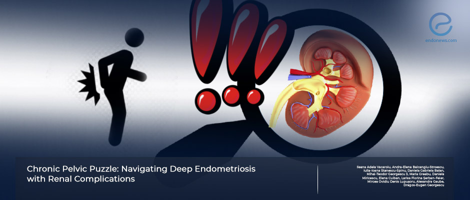 Beware of deep endometriosis involving ureter