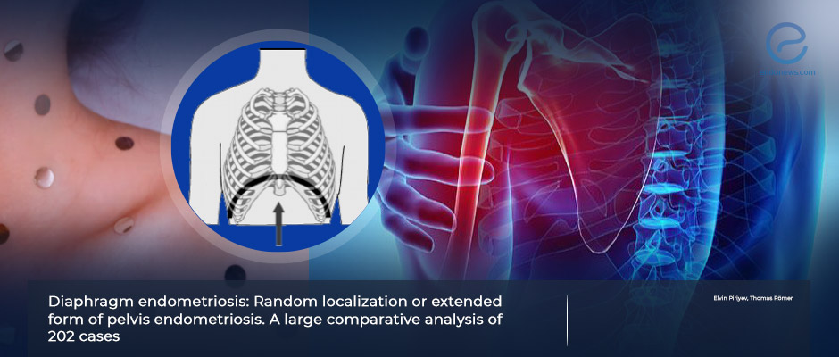 New visions on diaphragmatic endometriosis 