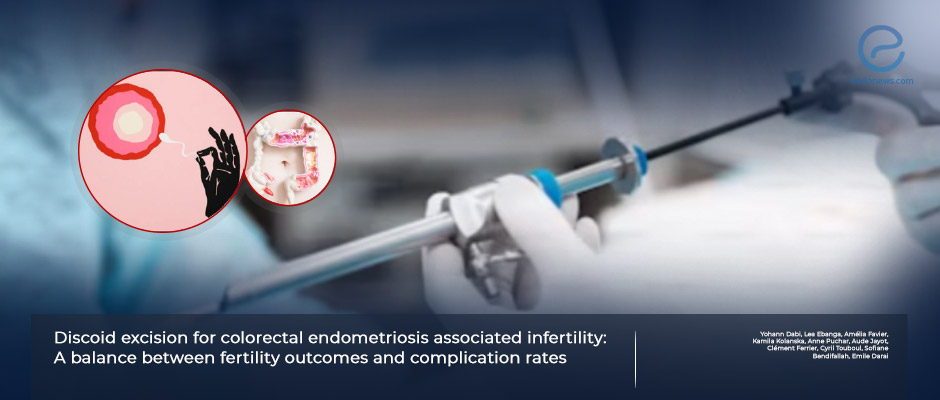 Fertility outcomes after discoid excision for colorectal endometriosis.
