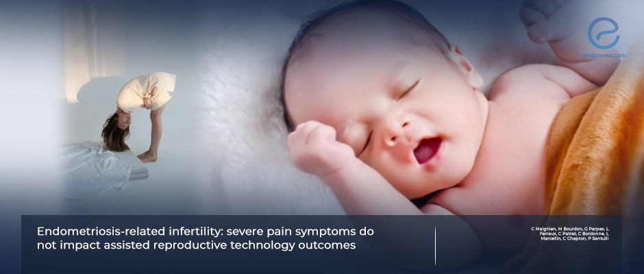 Does The Severity of Endometriosis Pain Affect the Chance of Having a Baby With IVF?
