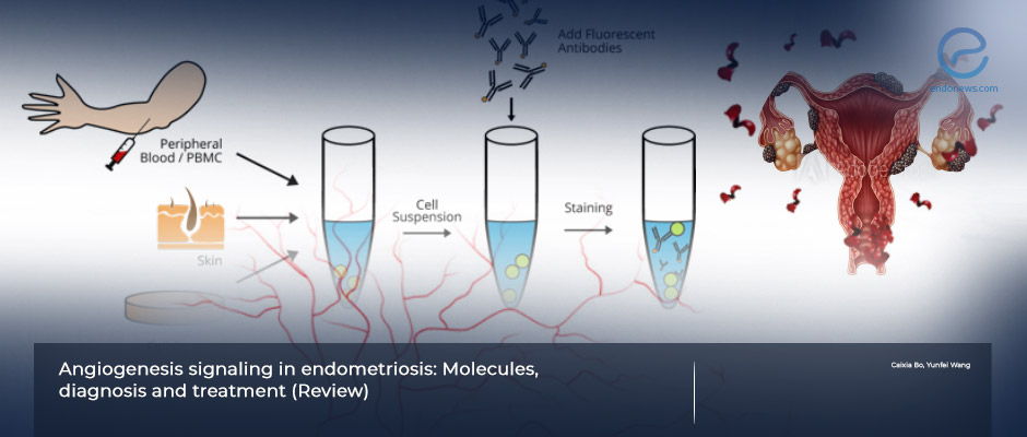 Hot research in endometriosis; new vessel formation: angiogenesis