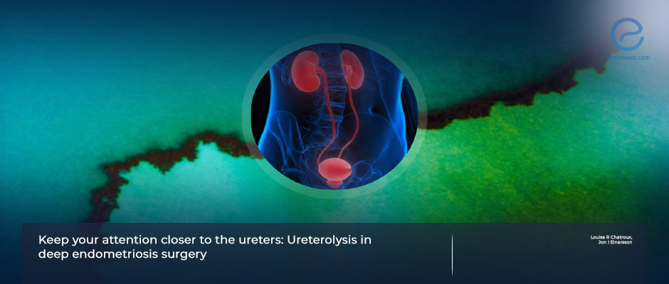 Key Aspects of Ureterolysis in deep endometriosis surgery