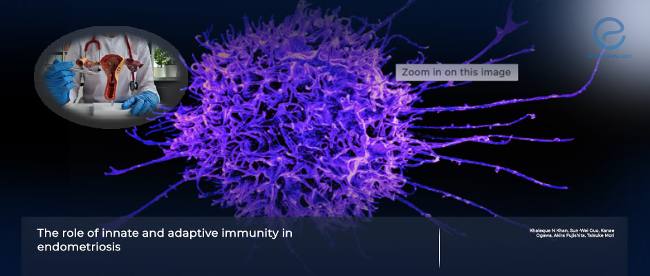 The role of immunity in endometriosis