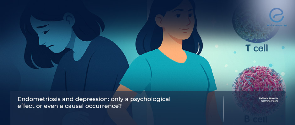 Which Comes First: Endometriosis or Depression? 