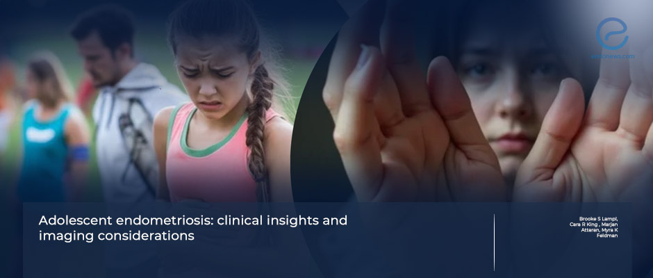 Endometriosis in Youth: Diagnostic and Treatment Insights