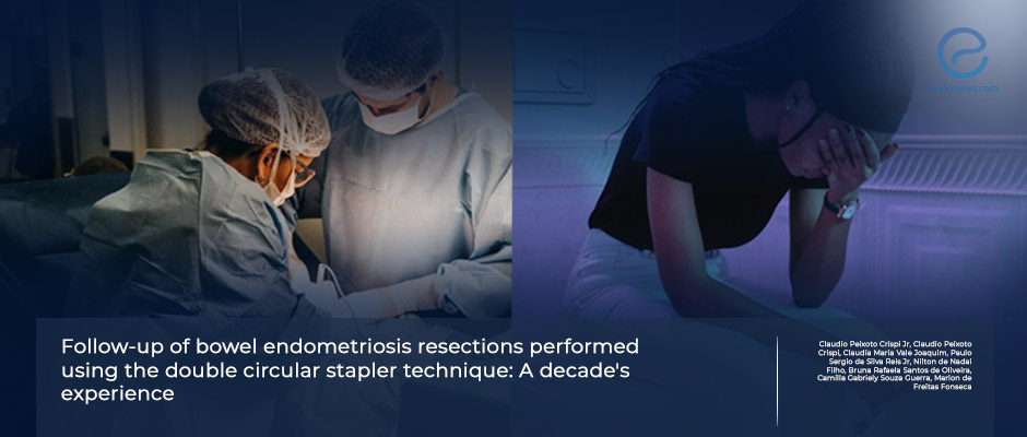 Double Circular Stapler Technique: A Safe and Effective Approach for Colorectal Deep Endometriosis