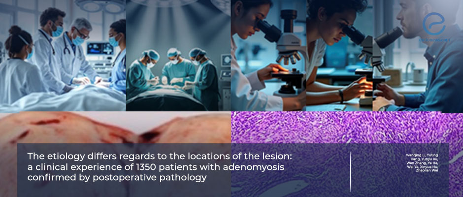 Demystifying Adenomyosis: The Role of Anatomic Categorization