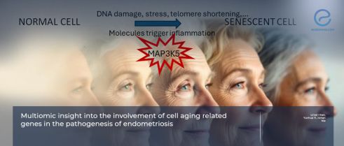 Cell-Aging-Related Pathways Linked to Endometriosis Pathogenesis