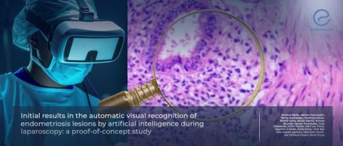 AI-Assisted Vision: Recognizing Endometriosis in Real Time