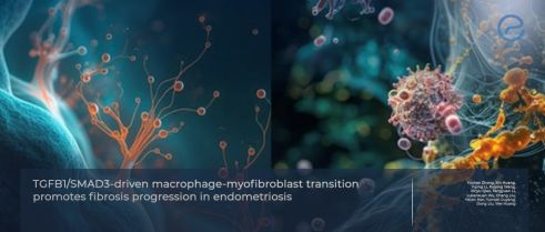 Macrophages Become Myofibroblasts in Endometriosis Fibrosis