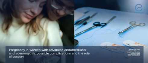 Advanced Endometriosis and Pregnancy Outcomes