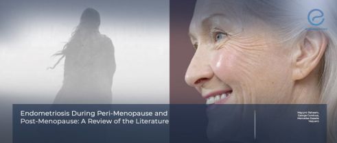 Endometriosis After Menopause