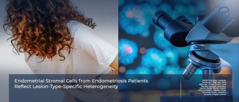 Lesion-Specific Stromal Cell Behavior in Endometriosis