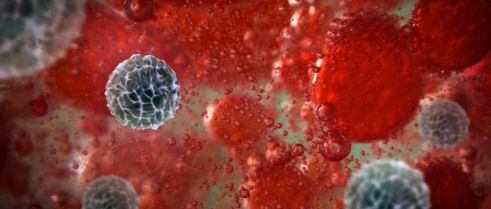 T-Cell Dysfunction May Worsen Endometriosis