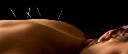 Effects of acupuncture for the treatment of endometriosis-related pain