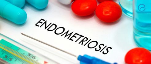 Investigational Medical Therapies for Endometriosis: Current Data and Future Trends. 