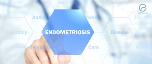 The Deregulated Molecular Functions Involved in Malignant Transformation of Endometriosis to Endometriosis-Associated Ovarian Carcinoma
